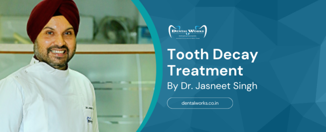 Tooth Decay Treatment