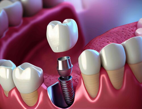 Dental Implants: Your Complete Guide to a Confident, Healthy Smile