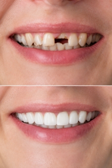 Restorative Dentistry