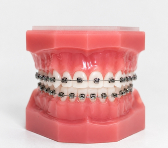 Self Ligating Demon Braces